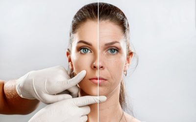 Understanding Botox for a Youthful Look